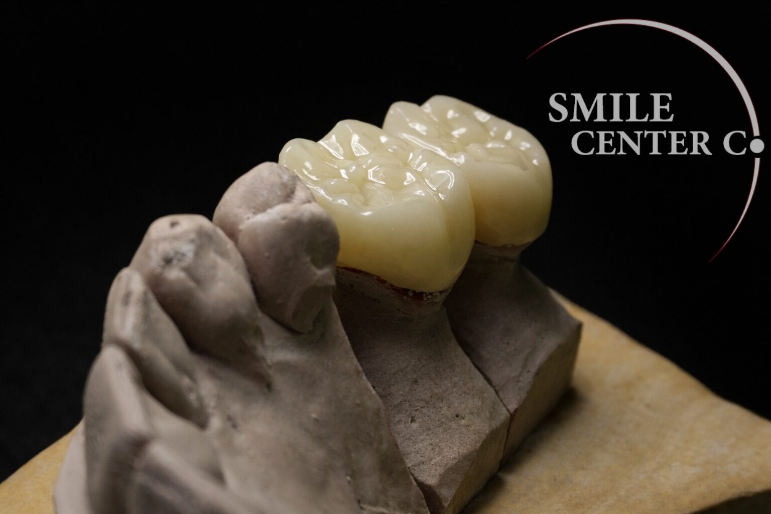 Laboratorio dental